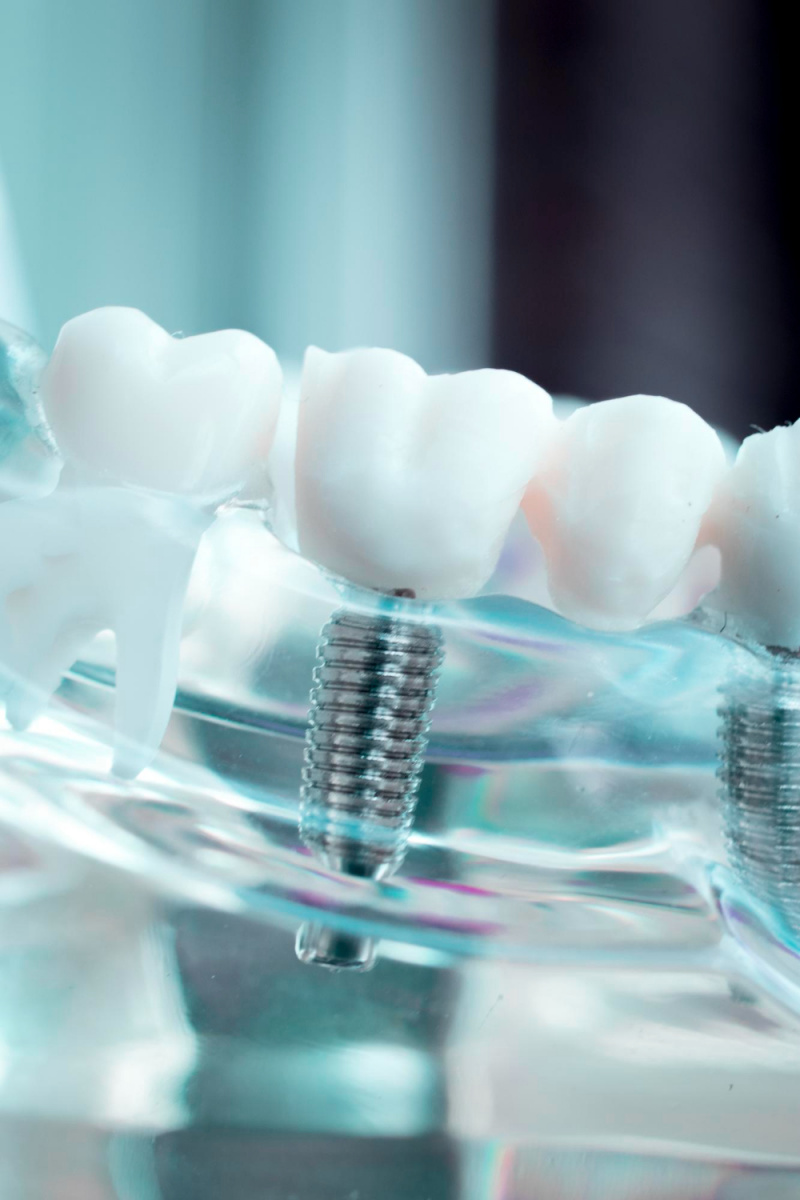 врач имплантолог